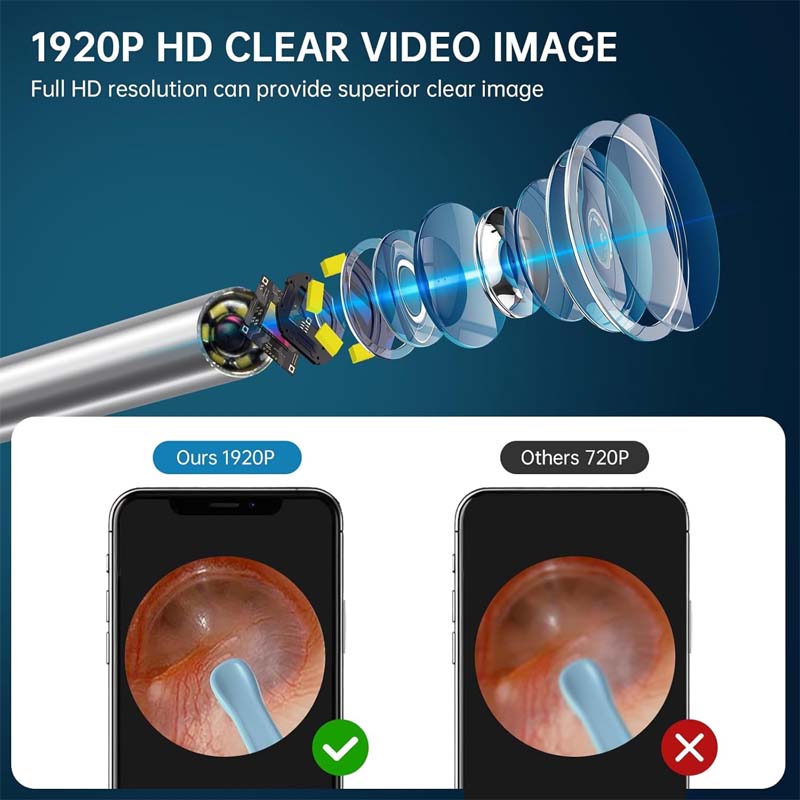 HD Camera Ear Wax Removal Kit